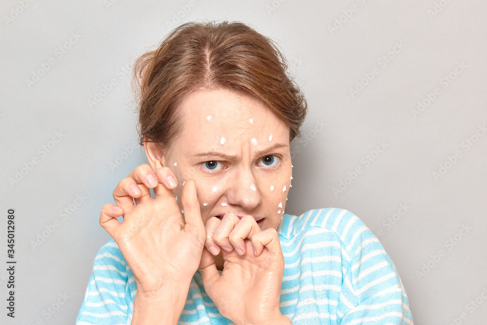 Portrait of frightened girl with white drops of face cream on skin Portrait of frightened girl with white drops of face cream on skin