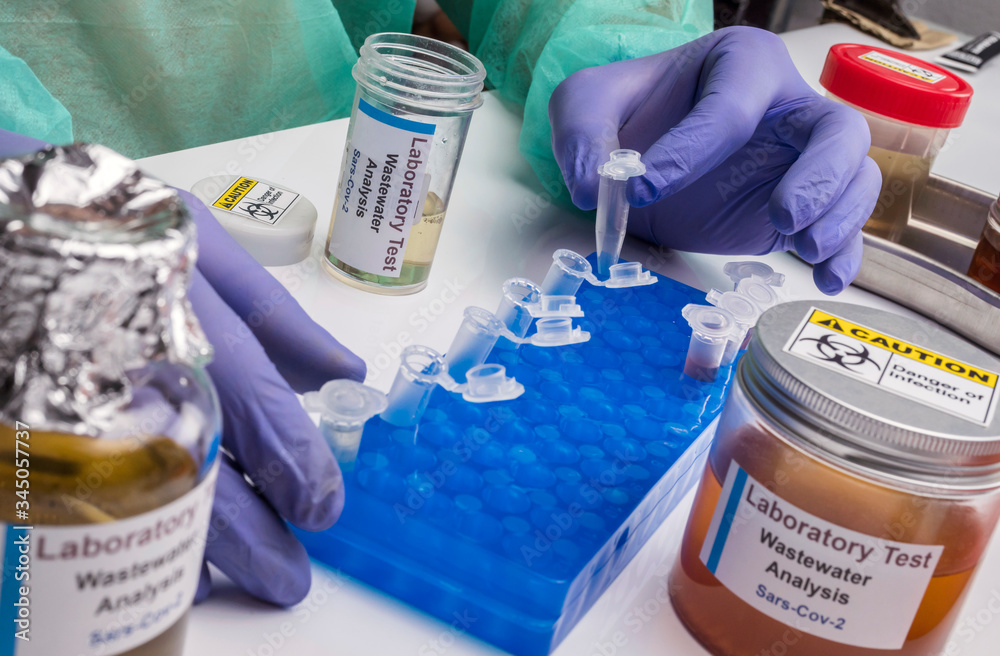 Foto de Scientific analysis of wastewater sample in laboratory