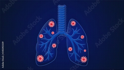 Medical animation of SARS-CoV-2 coronavirus infected lungs causing diffuculty in breathing or pneumonia or othercovid-19 related lung disease. 3d medical animation. Loopable animation. 3d