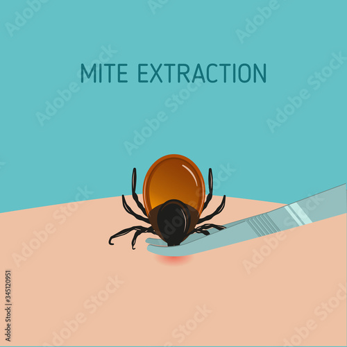How to remove mite insect parasitic. Encephalitis Tick Warning