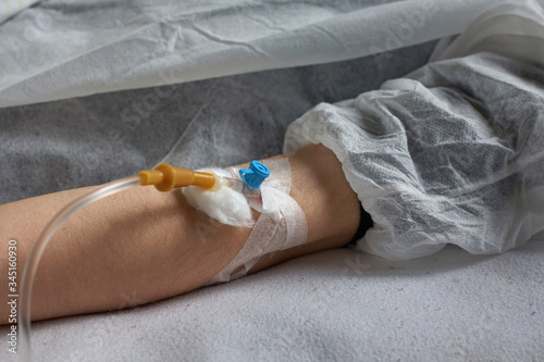 A peripheral venous catheter is inserted into a vein on the arm.