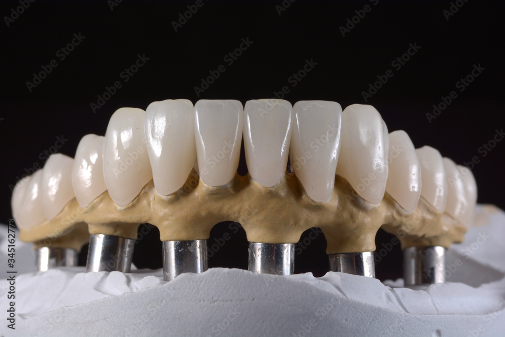 artificial dentition and instruments in a dental laboratory artificial dentition and instruments in a dental laboratory