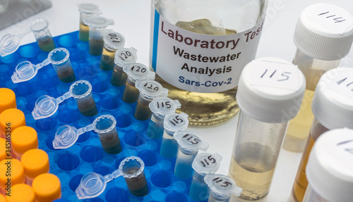 Canvas Print Wastewater samples, analysis of sars-cov-2 virus in patients infected by human c