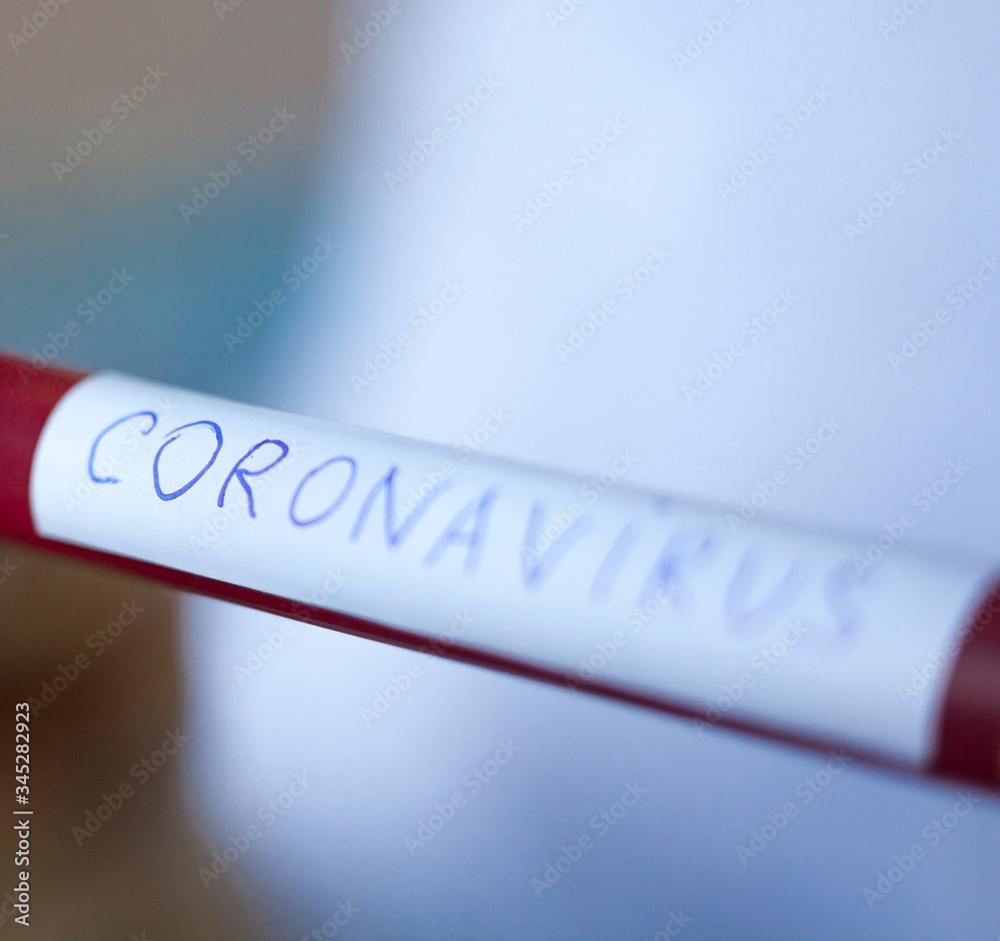 Obraz premium Blood test tube. Testing for Coronavirus disease.