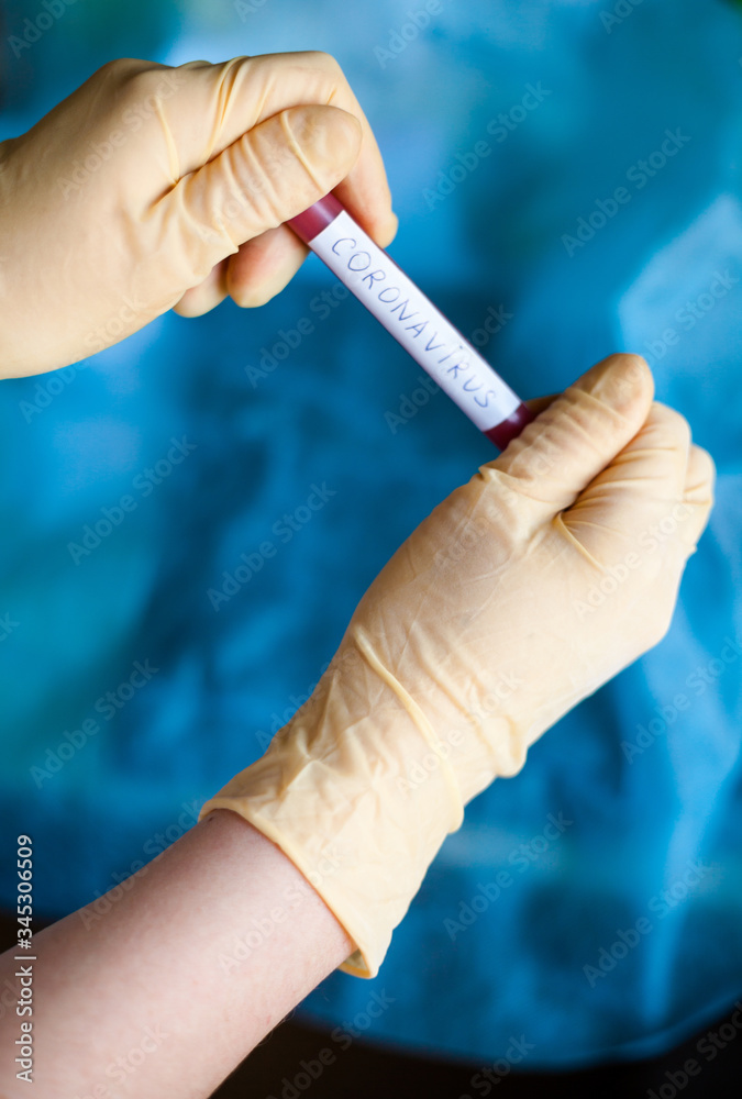 Hands holding blood test result for Coronavirus