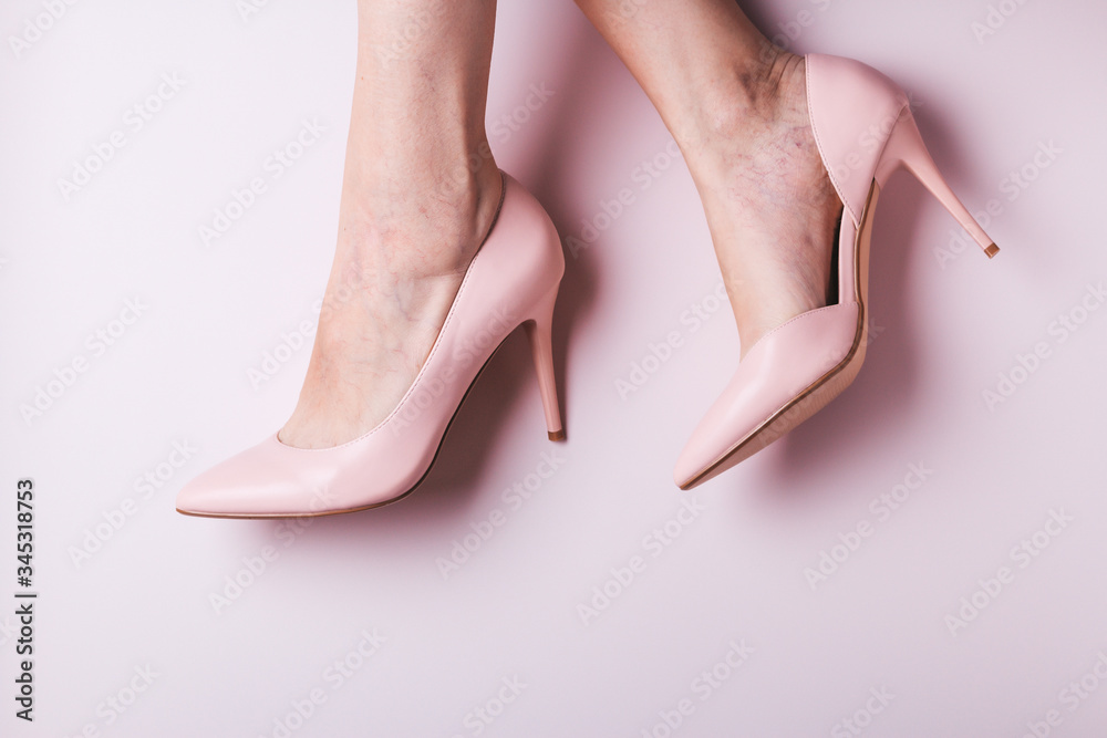 Woman feet in pink shoes closeup with small spider veins, leg disease. Unhealthy side effect of wearing high heels that provokes varicose veins, copy space, top view Woman feet in pink shoes closeup with small spider veins, leg disease. Unhealthy side effect of wearing high heels that provokes varicose veins, copy space, top view