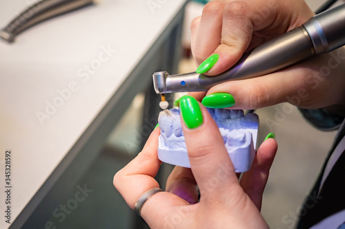 A dental technician makes a model of a human jaw. The girl with green nails works as a dentist. Denture. Correction of bite. Dentistry. Dental services.
