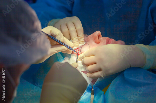 Close up of surgeons hands performing an incision on the upper eyelid of the patient starting the blepharoplasty operation
