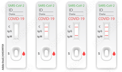 Set of rapid test for antibodies to coronavirus with different results Ig M and Ig G result. Presence or absence of Covid 19 virus and infectious disease Sars 2019-nCoV.