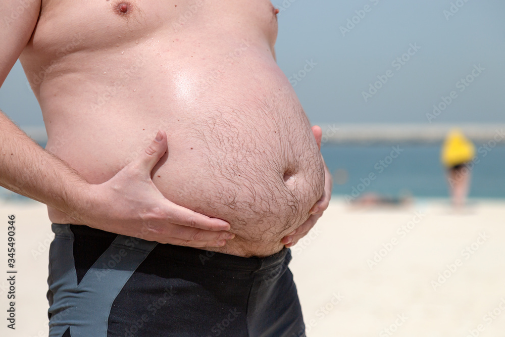 Male big belly, obesity problem. A man holds his huge fat belly