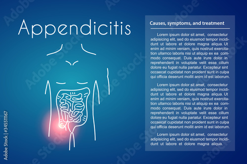 Vector Appendicitis Blue Background