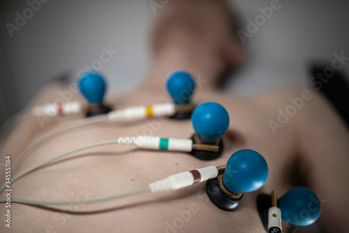 A patient with EKG electrodes attached to his body.