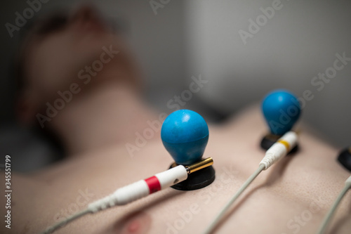 A patient with EKG electrodes attached to his body.