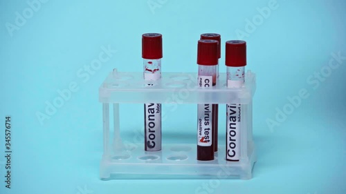 cropped view of doctor putting test tubes with coronavirus lettering on blue