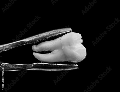 bad real tooth removed in the dental forceps on black background