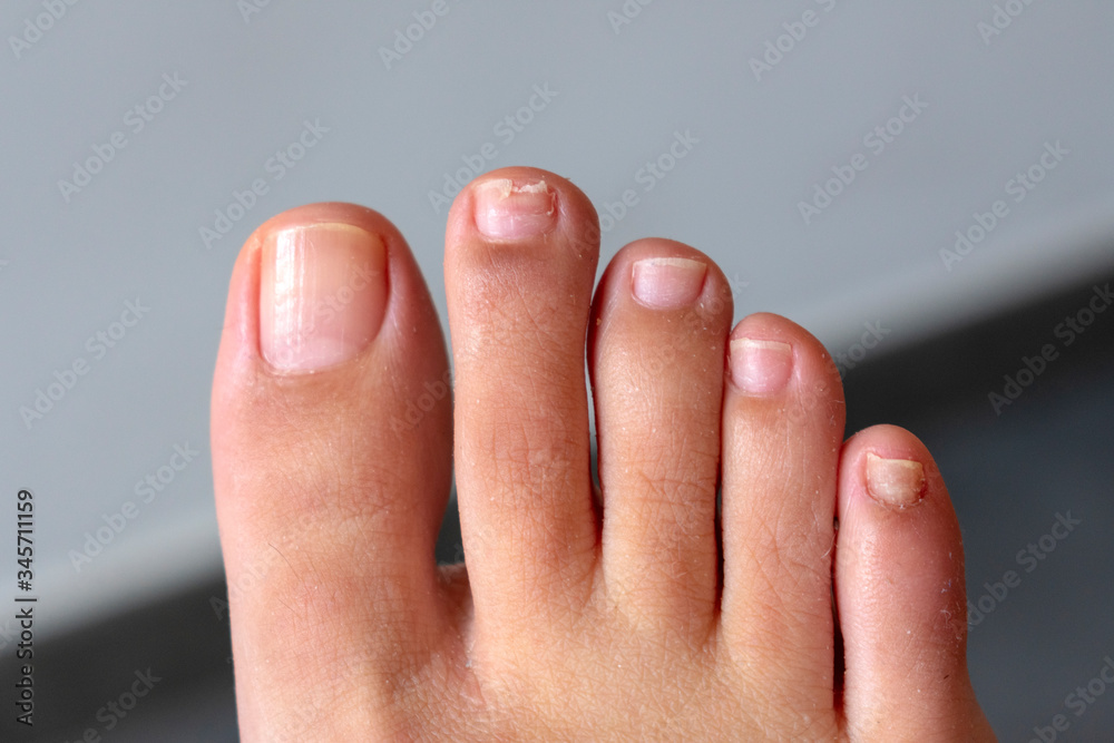 natural toes Stock-Foto
