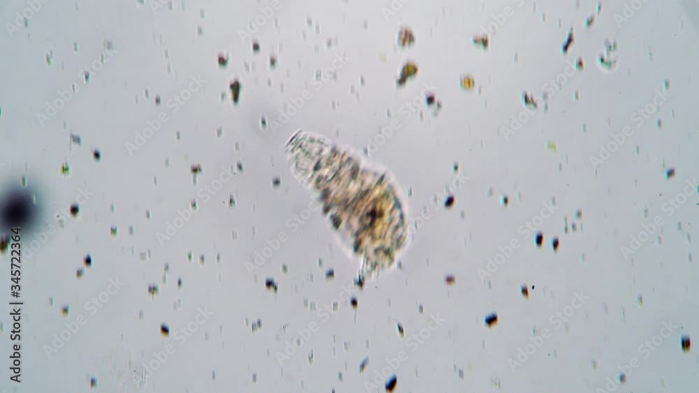 Moving a rotifer close up in fresh water under a microscope. Theme of ...