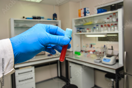 Blood testing in the laboratory.