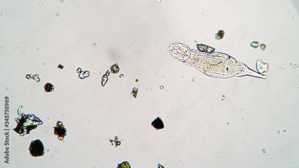 Microscopic animal rotifer in drop of water from pond under a ...