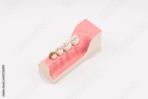 Dental education and study model of teeth.