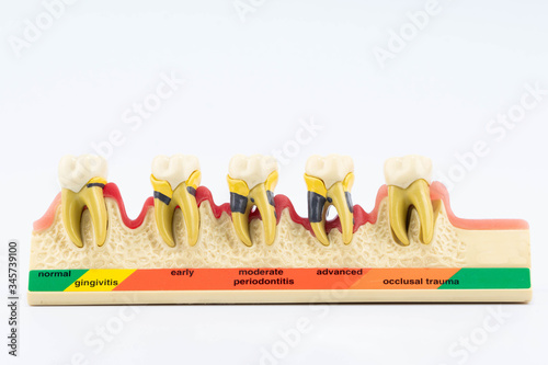 Dental education and study model of teeth.