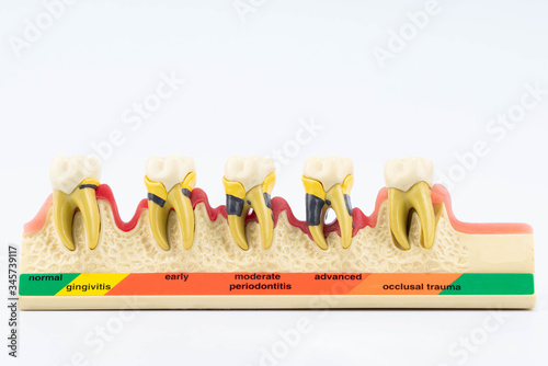 Dental education and study model of teeth.