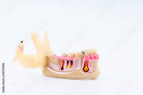 Dental education and study model of teeth.