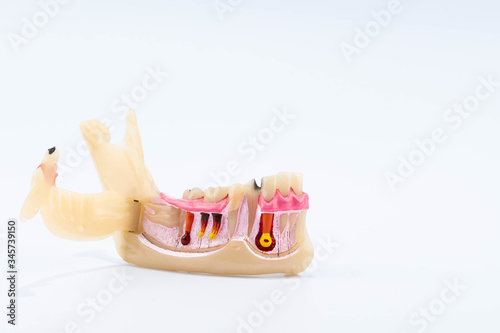 Dental education and study model of teeth.