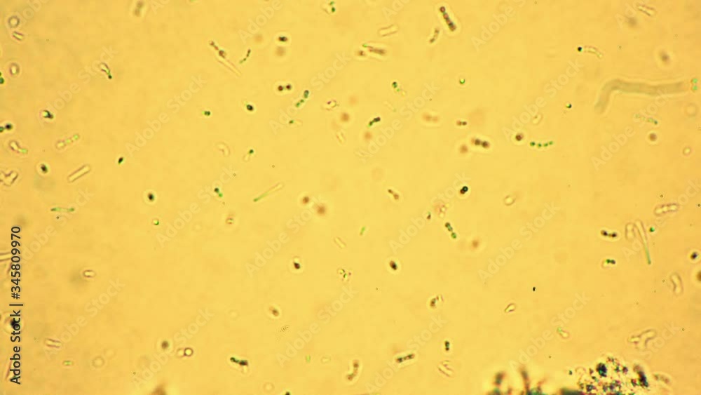 Group of little lactic acid bacteria are moving slowly under the microscope. Colony of tiny bacillas are floating over the yellow background. Theme of useful microorganisms in dairy products. Group of little lactic acid bacteria are moving slowly under the microscope. Colony of tiny bacillas are floating over the yellow background. Theme of useful microorganisms in dairy products.