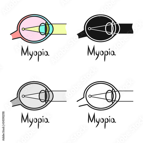 Vector illustration of myopia and eye symbol. Web element of myopia and cornea stock symbol for web.