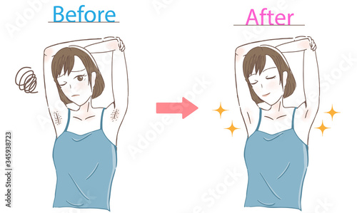 肩こりを気にする女性　ビフォーアフター