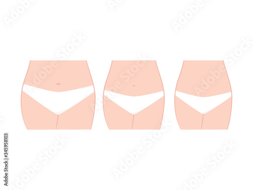 Fat, normal and slim woman body. Weight loss concept, before and after vector illustration isolated on white background.