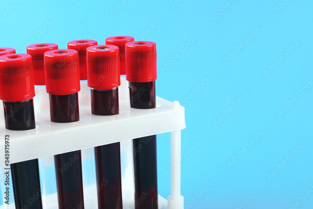 blood collection vacuum tubes on a blue background with place for text blood collection vacuum tubes on a blue background with place for text