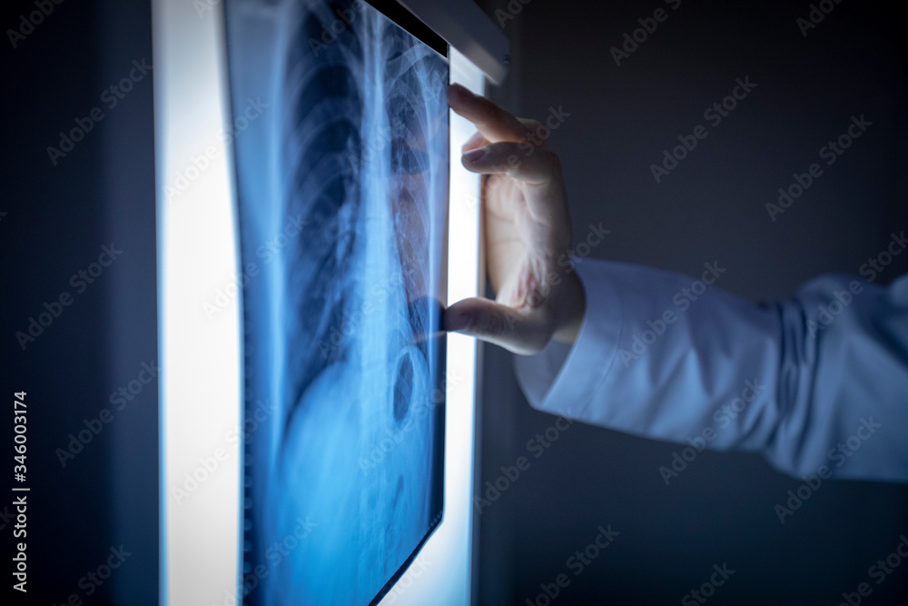 Doctor checking x ray film and examining lungs