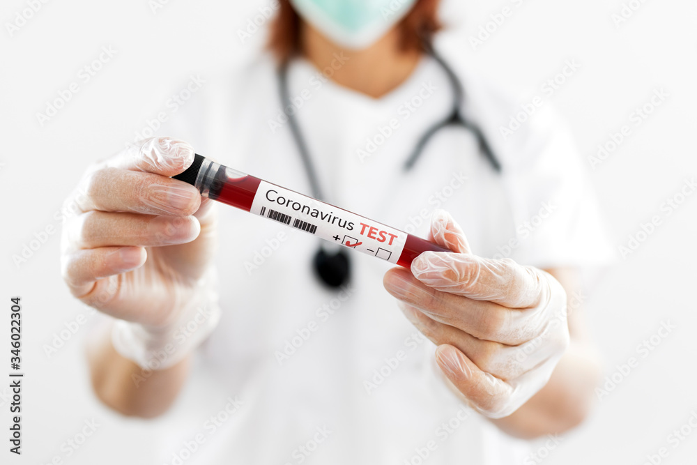 Nurse holding a positive blood test result Nurse holding a positive blood test result