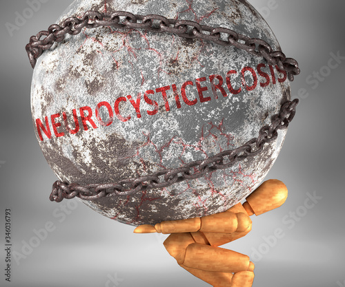 Neurocysticercosis and hardship in life - pictured by word Neurocysticercosis as a heavy weight on shoulders to symbolize Neurocysticercosis as a burden, 3d illustration photo