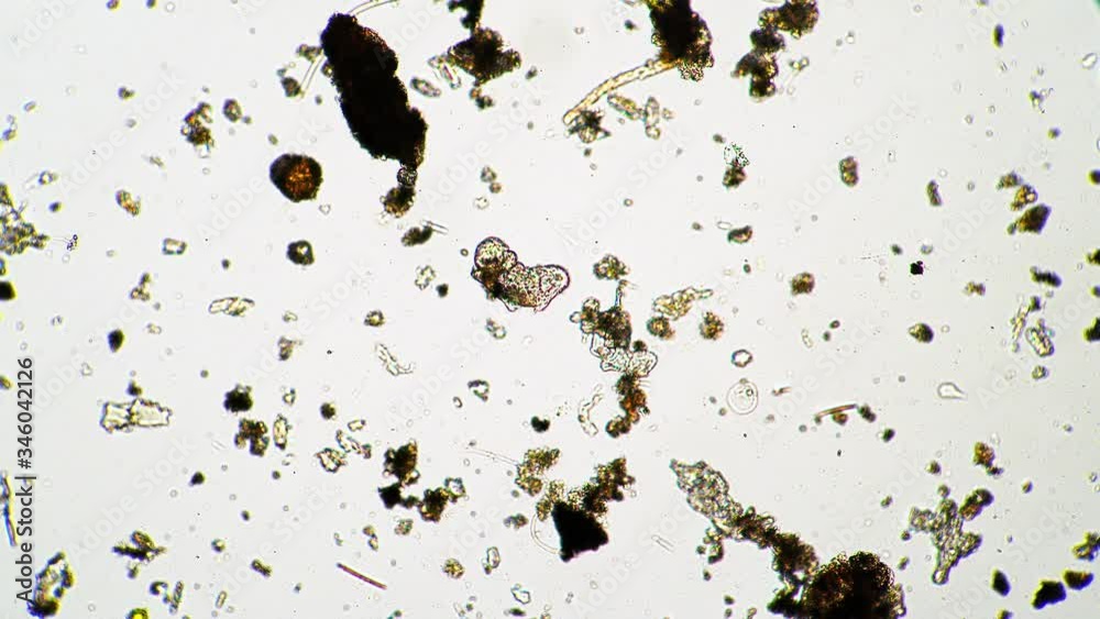 Micro animal water bear moves quickly in dirty water from moss under a microscope. Theme of laboratory biological research under microscope. Microscopic animal in a drop of water under magnification. Micro animal water bear moves quickly in dirty water from moss under a microscope. Theme of laboratory biological research under microscope. Microscopic animal in a drop of water under magnification.