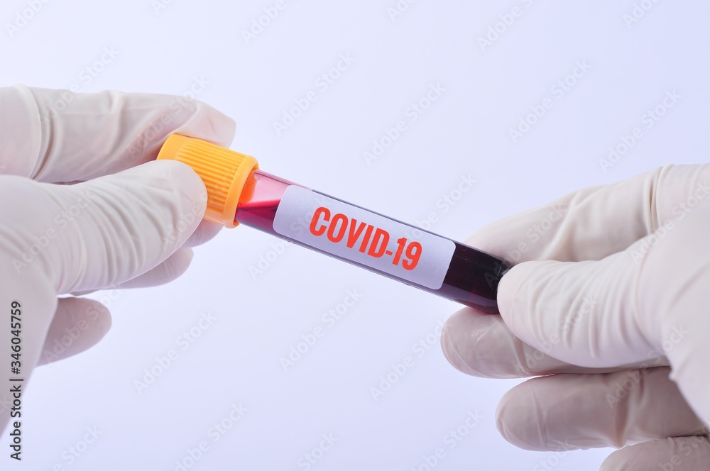 Obraz premium hand hold covid-19 blood test tube
