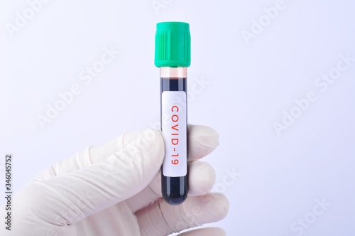 hand hold covid-19 blood test tube