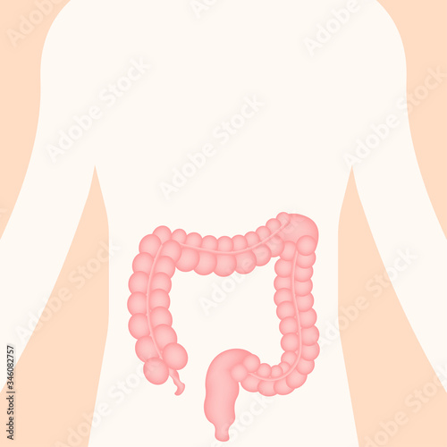 Colitis for medical design. Gastroenterology. Gut constipation icon design. Health care. Vector stock illustration.