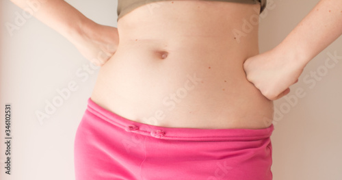  A young woman shows moles on her stomach. Birthmark concept