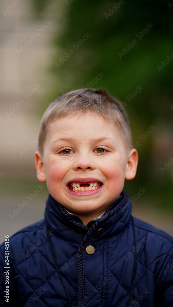 Portrait of a boy with fallen front teeth. Baby smiling Portrait of a boy with fallen front teeth. Baby smiling