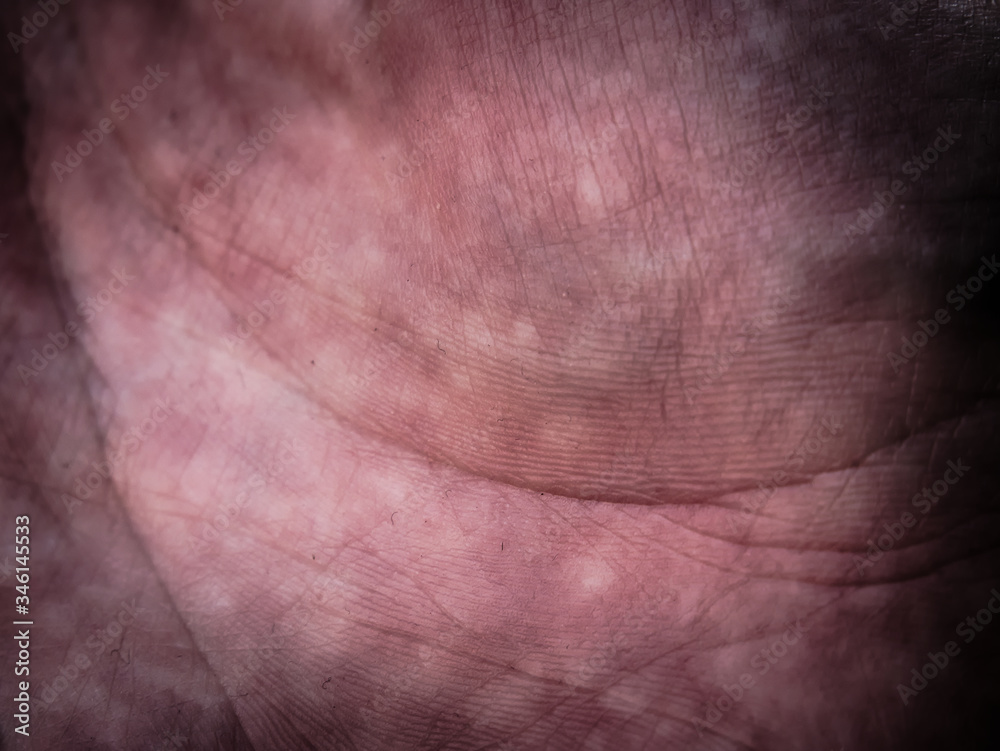 Papillary lines symbolizes our way of live and age. Papillary lines symbolizes our way of live and age.
