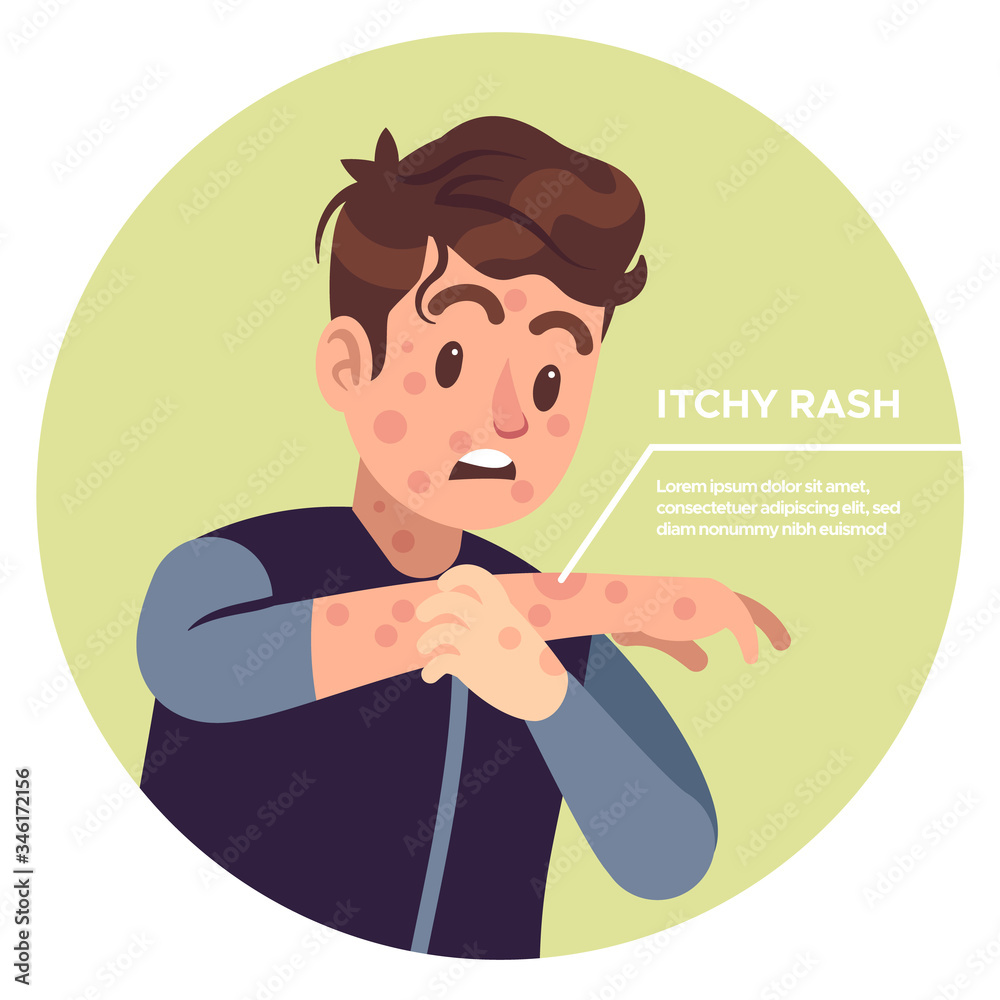 Man scratching arms. Allergic inflammation, irritation itchy, scratched eczema, allergy skin strong pain healthcare problems vector concept Man scratching arms. Allergic inflammation, irritation itchy, scratched eczema, allergy skin strong pain healthcare problems vector concept