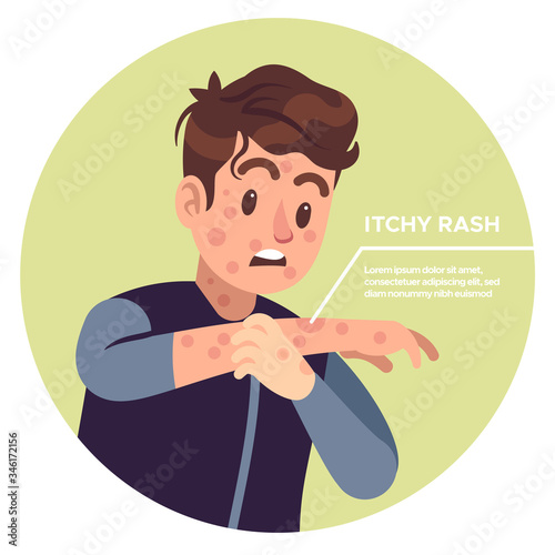 Man scratching arms. Allergic inflammation, irritation itchy, scratched eczema, allergy skin strong pain healthcare problems vector concept