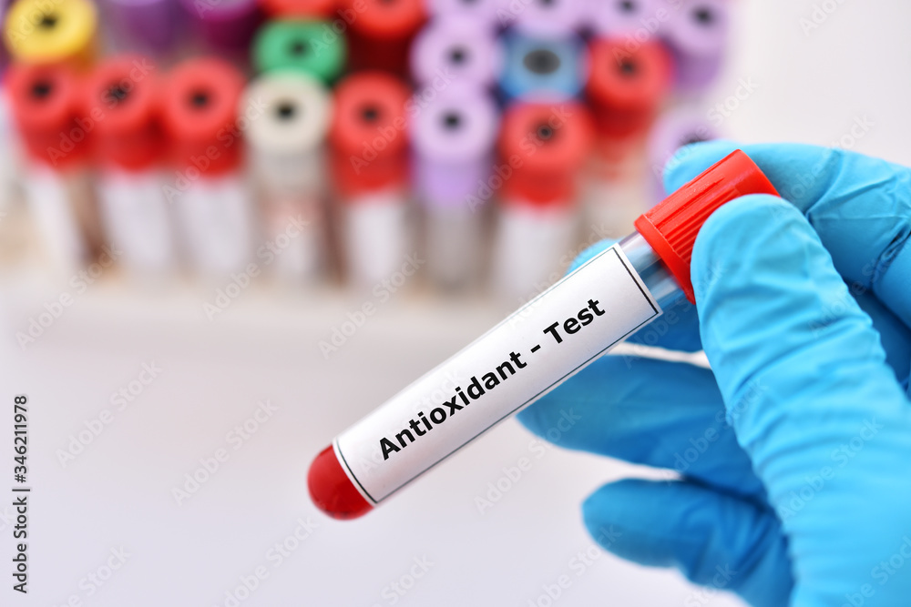Obraz premium Test tube contain with blood sample for antioxidant test