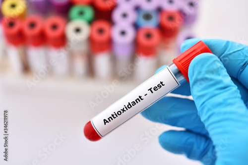 Test tube contain with blood sample for antioxidant test photo