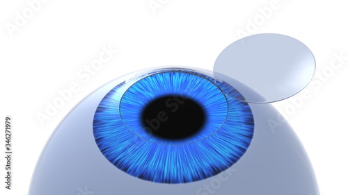 Corneal flap eye illustration. Isolated on white. 3D-rendering. photo