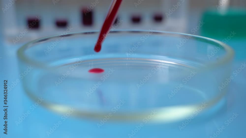 Scientists Works with blood samples and pipette on Petri Dishes. Close-up Pipette with drop of blood. Blood test. Scientists Works with blood samples and pipette on Petri Dishes. Close-up Pipette with drop of blood. Blood test.