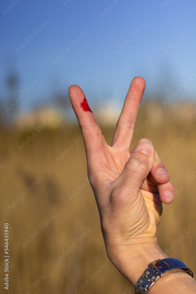 Mans bleeding hand showing victory sign in the field Farmer cut his finger. Rural lifestyle, summer time. Hard working life. Concept of victory win and power, workers day. Silver wrist watch Mans bleeding hand showing victory sign in the field Farmer cut his finger. Rural lifestyle, summer time. Hard working life. Concept of victory win and power, workers day. Silver wrist watch
